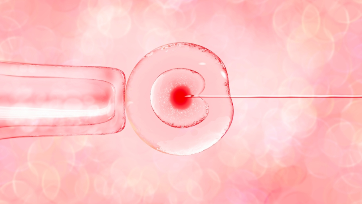 Intracytoplasmic Sperm Injection (ICSI)