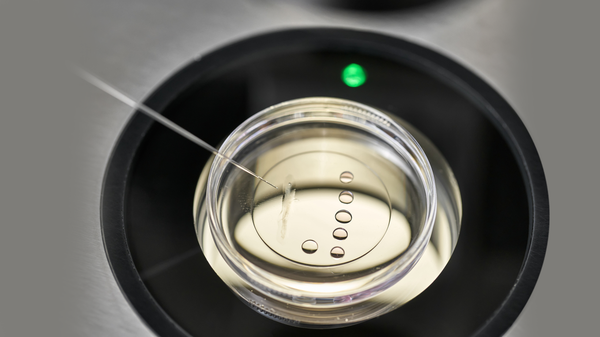 In-Vitro Fertilization <br>(IVF)