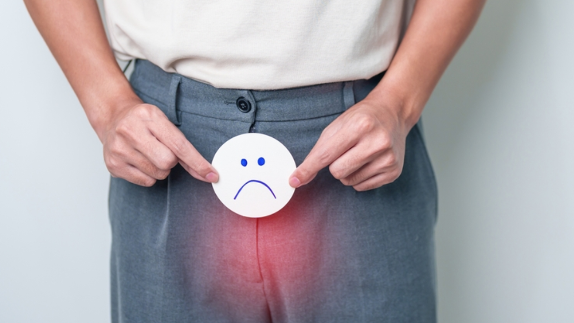Male Infertility
