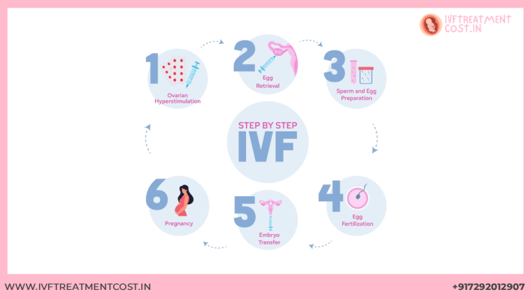 IVF Process Step by Step – Complete Procedure Explained