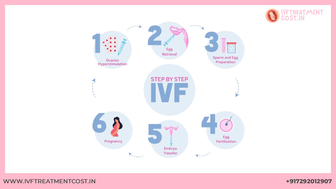 IVF Process Step by Step – Complete Procedure Explained